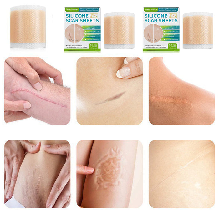 Silicone Wound Decrease Scar Patches